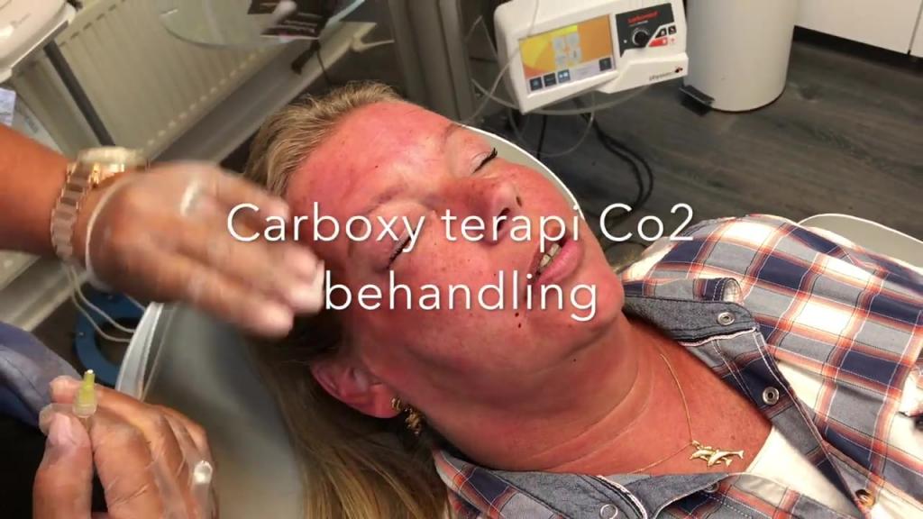 Carboxy Behandling